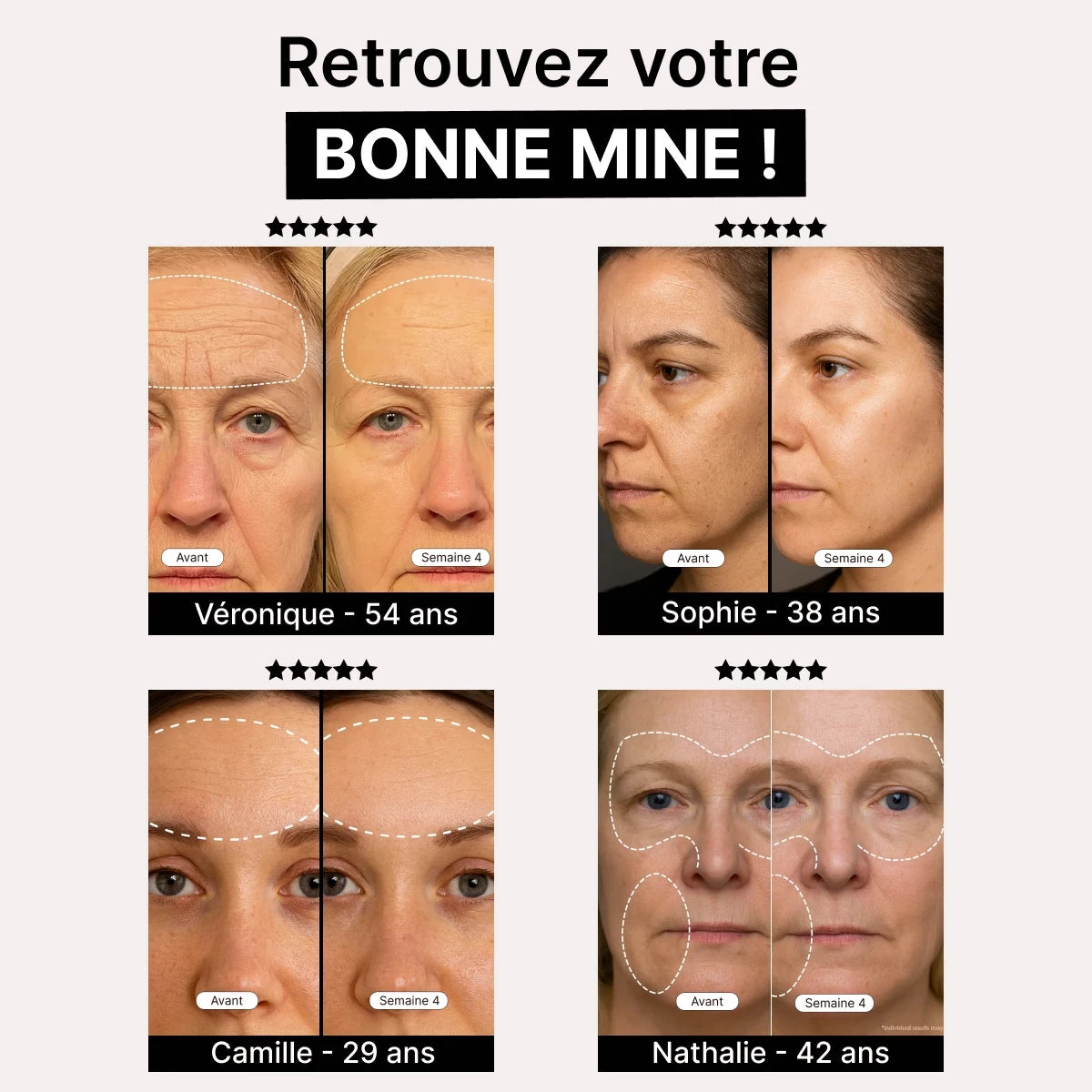 DermaLux | Masque Luminothérapie LED Pro