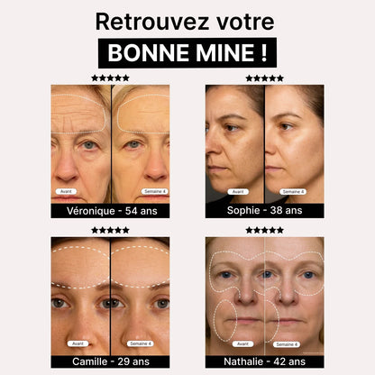DermaLux | Masque Luminothérapie LED Pro