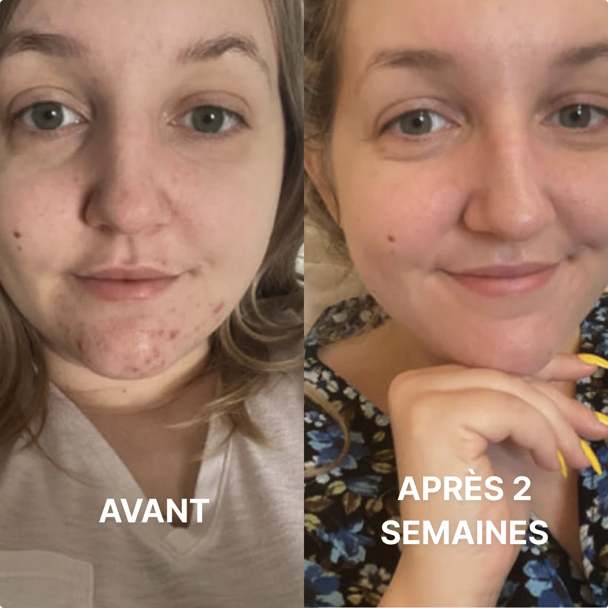 Masque Collagène Glow Up 2.0